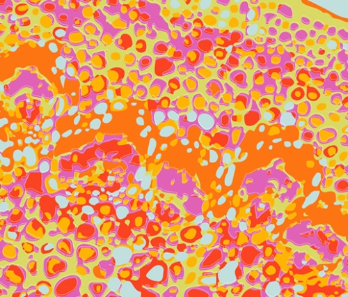 TLI-Pattern-Dandelion-Lilac
