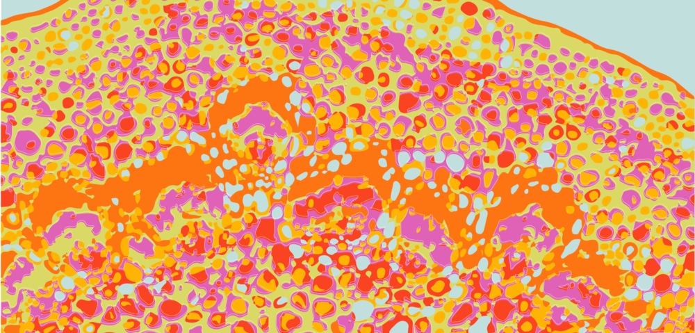 tli-pattern-Dandelion- Lilac